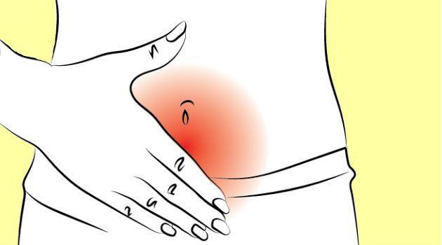 ANEXITES É um processo inflamatório que ocorre nas tubas uterinas e ovários, podendo atingir os dois órgãos uni ou bilateralmente.