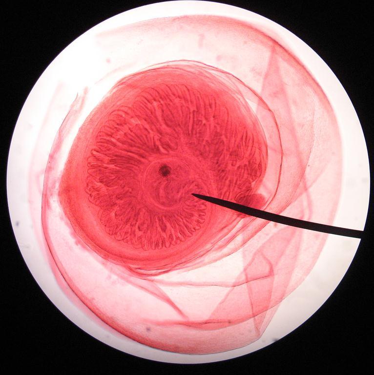 LAM Nº 55 Cisticerco de Taenia solium Coloração: Carmin Material de preparação: