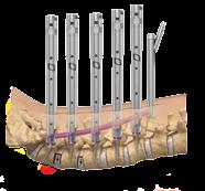 hastes de 5,5mm e 6,25mm Armada TM Sistema principal