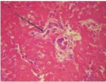 Os exames histopatológicos dos hemangiossarcomas apresentaram proliferação de células endoteliais imaturas formando espaços vasculares com presença ou não de células sanguíneas no seu interior.