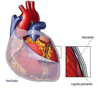 Pericárdio e