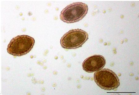 14 Figura 2 Ovo de D. renale encontrado em sedimento urinário de cão parasitado.