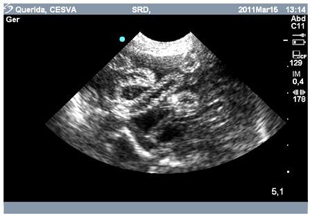 22 Figura 9 Imagem de ultrassonografia de saco gestacional parasitado por D. renale. Imagem ultrassonográfica em modo B do útero. Nota-se a presença de estruturas cilíndricas.