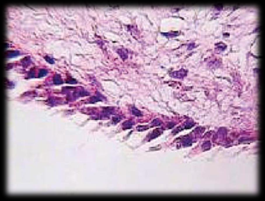 tecido conjuntivo fibroso e é revestida por epitélio escamoso estratificado não queratinizado de espessura variável.