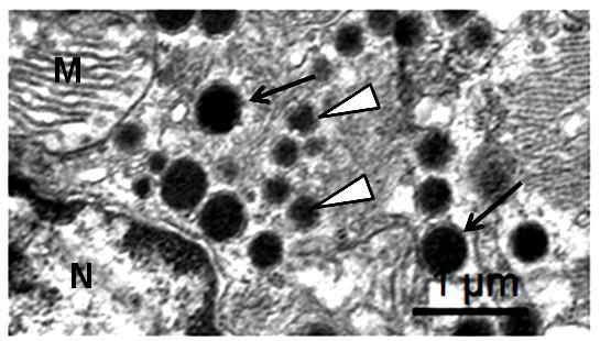19 Figura 1 Micrografia eletrônica de corte de cardiomiócito de átrio direito de rato Wistar, visto com grande aumento, mostrando grânulos de ANP (setas) e de BNP (cabeças de setas) no citoplasma do