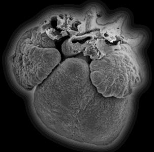 Anatomia do Coração DESENVOLVIMENTO DO