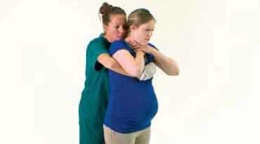 Quando a pessoa está obviamente grávida ou obesa, use compressões torácicas em vez de compressões abdominais. Posicione-se diretamente atrás da pessoa.