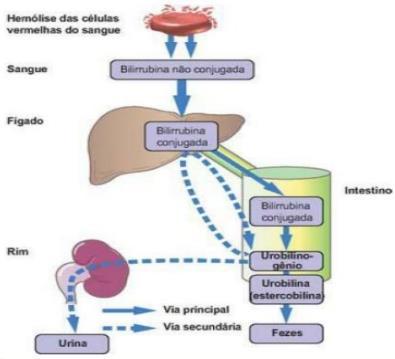 O rompimento dos eritrócitos libera mais hemoglobina na circulação, o catabolismo da mesma aumenta os níveis de bilirrubina indireta, o que além de causar icterícia, favorece a formação de cálculos