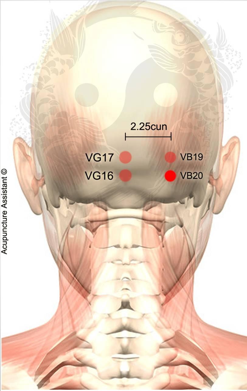 VB20