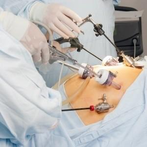 conventional multiport laparoscopy, which has been shown to be technically feasible and safe.