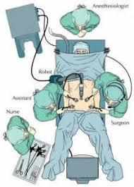 A primeira comunicação sobre cirurgia laparoscópica foi EUA 1980 Em 1990 há um aumento de procedimentos laparoscópicos Desafios Pacientes