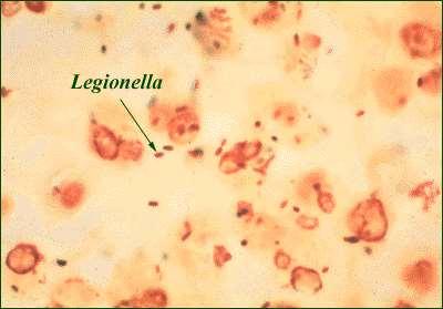 Infeções e sintomas provocados nos seres humanos LEGIONELOSE Doença dos Legionários (pneumonia) Má disposição (dores de cabeça e tosse) Febres muito altas,