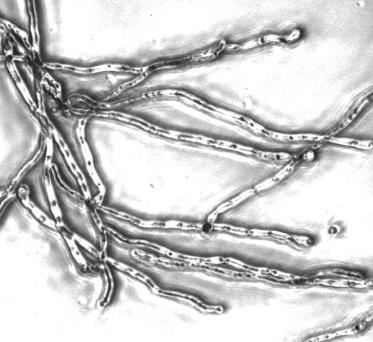 Os fungos filamentosos podem crescer na faixa entre 1,5 e 11, mas as leveduras não toleram ph alcalino. Muitas vezes, a pigmentação dos fungos está relacionada com o ph do substrato.