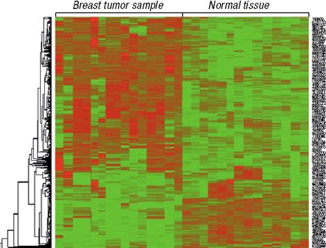 Heatmap Coluna = paciente; Linha = gene