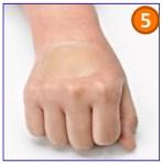 5) Pressione suavemente as bordas do curativo sobre a pele do paciente para melhor contato. Remoção 1) Pressione a pele suavemente para baixo até a borda do curativo começar a levantar.