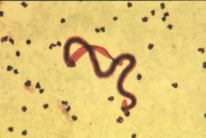 Nessa imagem vemos, entre as hemácias, os parasitas Trypanossoma cruzi, agente etiológico da Doença de Chagas,