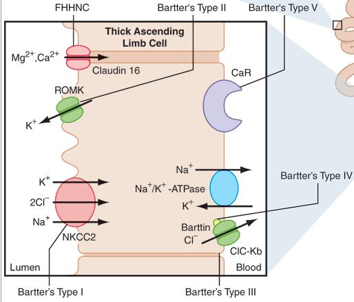 Diagnóstico diferencial SÍNDROME DE BARTTER E SÍNDROME DE GITELMAN Doenças genéticas com defeito na reabsorção de sódio e cloro Ansa Henle Ascendente Bartter Diuréticos de ansa Ducto contornado