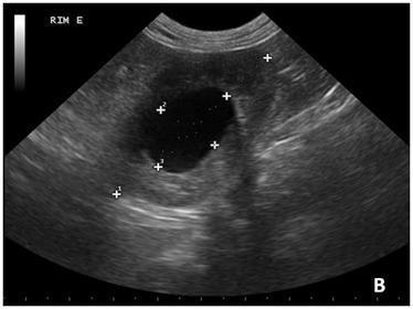DISCUSSÃO No desenvolvimento embrionário do sistema urinário dos mamíferos, o ureter se forma a partir do ducto metanéfrico, que deriva da porção distal do mesonefro, o qual, por sua vez, dará origem