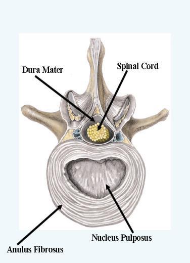 Clinical Anatomy Intervertebral Discs: 23 intervertebral discs No disc between skull and C1 or between C1-C2 Discs are thickest in the lumbar vertebrae and cervical regions