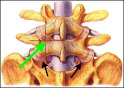 Pars Interarticularis: Area