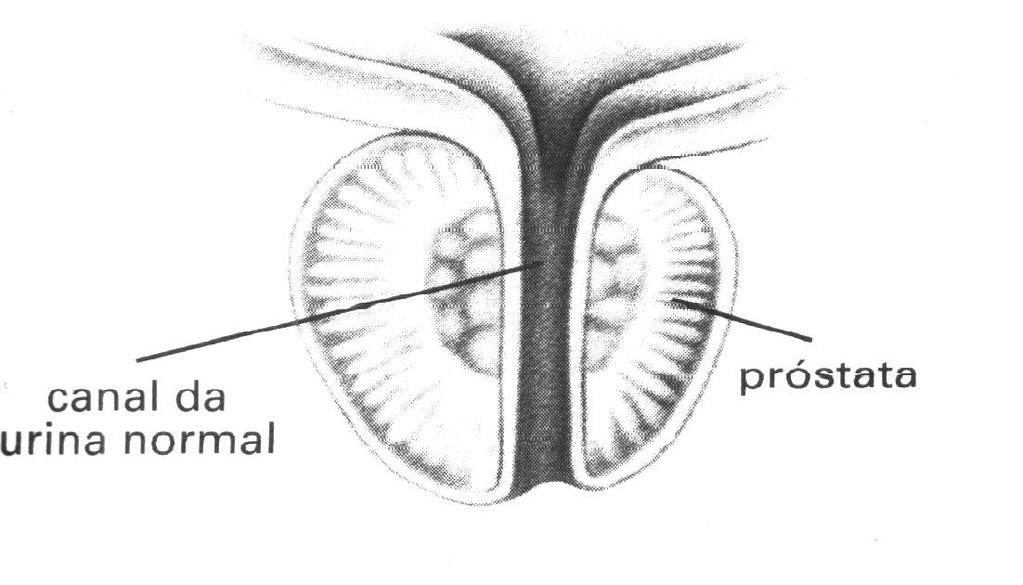 A próstata fica localizada logo abaixo da bexiga. Pesa aproximadamente 20 gramas e tem a forma de uma maçã.