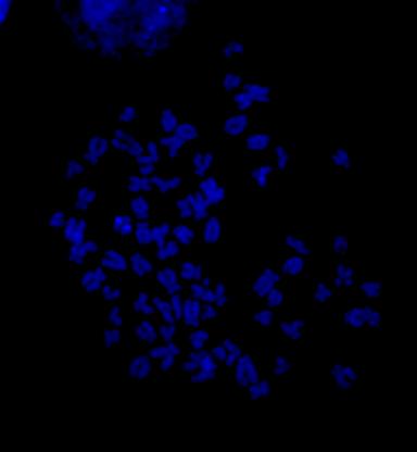 Figura 7a: Dupla coloração CMA3/DAPI aplicada em cariótipo de fêmea, evidenciando o conspícuo bloco intersticial do cromossomo Z (seta branca), assim como as RONs em
