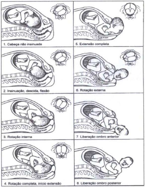 Figura - Período expulsivo do parto (Brasil, 2001). INSINUAÇÃO é passagem da maior circunferência da apresentação fetal por meio do estrito superior da bacia.