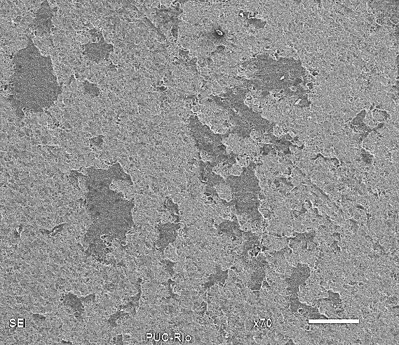 86 Porosidade Intercristalina Poro Poro 20 µm 20 µm 200 µm Figura 5.