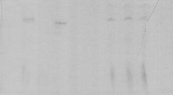 Pth-BJC BJC FIGURA 14: Formação in vitro do complexo botrojaracinaprotrombina de rato em plasma total.