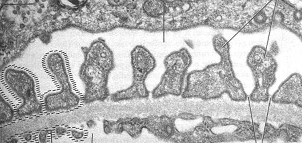 Podócito Membrana filtrante Endotélio capilar glomerular Epitélio da Cápsula de