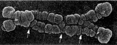 MEIOSE PRÓFASE I 3- Diplóteno: Cromossomos homólogos começam a se separar visíveis os