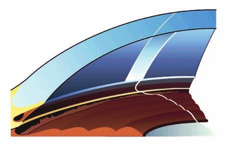 Gonioscopia: proposta de classificação (APIC) 335 Figura 3: O corte óptico permite a localização exata da linha de Schwalbe, facilitando enormemente a identificação das estruturas do seio camerular