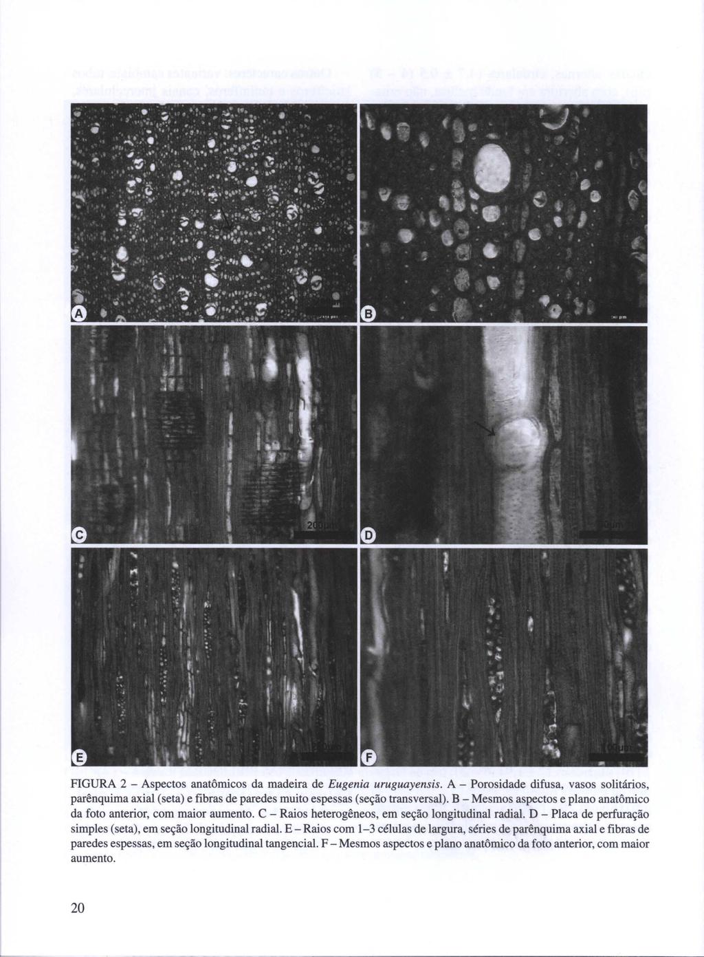 FIGURA 2 - Aspectos anatômicos da madeira de Eugenia uruguayensis. A - Porosidade difusa, vasos solitários, parênquima axial (seta) e fibras de paredes muito espessas (seção transversal).