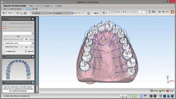 Acompanhando a revolução dos tomógrafos, novos softwares ajudam os profissionais no planejamento dos tratamentos. Devemos admitir que a Ortodontia ficou mais complexa nos últimos anos.