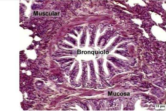 Brônquiolos: Segmentos interlobulares, não apresentam cartilagem, glândulas e nódulos linfáticos. Camada mucosa: Porção inicial: epitélio simples cilíndrico ciliado.