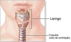 Laringectomia Complicações cirúrgicas: Atelectasias, pneumonias; Alterações olfativas e gustativas; Fístula laringea; Infecção da ferida operatória.