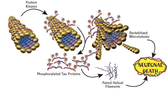 Proteína Tau: muito comuns