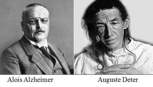 Aloysius Alzheimer (1907) Perda de memória Dificuldade na linguagem Confusão mental Faleceu com 51