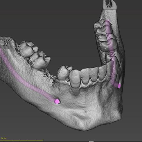 5.1 Fluxo de trabalho codiagnostix TM 1.