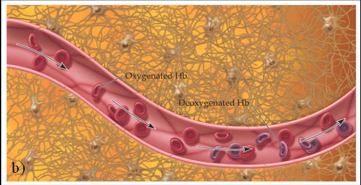 Existe uma diminuição momentânea na oxigenação sanguínea imediatamente após o aumento da actividade neuronal, conhecida como initial dip na resposta hemodinâmica.
