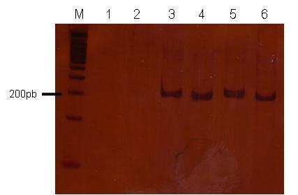 Resultados e Discussão 82 (Rochester, Estados Unidos). Foram utilizados dois pares de primers do laboratório que apresentavam bons resultados. Primer A gene MSH2. Primer B gene MSH6.