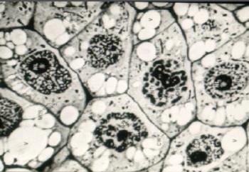 Características das células meristemáticas Meristemas e Crescimento primário Células pequenas e isodiamétricas; Parede celular delgada; Citoplasma denso;