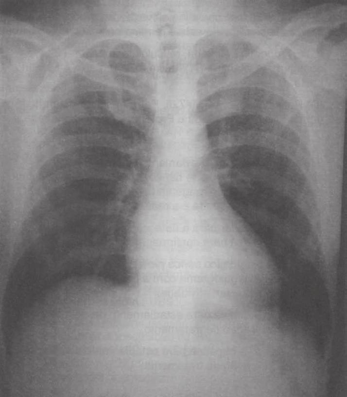 Questões Pneumologia Bases anatômicas da respiração 2016 - HSPE 1.