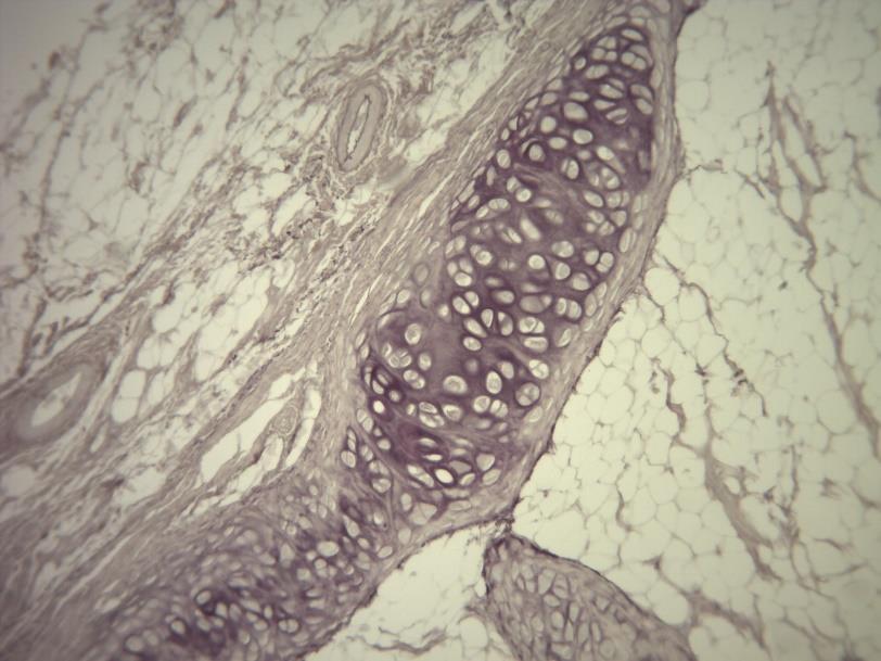 LÂMINA C2 TECIDO CARTILAGINOSO ELÁSTICO EPIGLOTE RESORCINA-FUCSINA Corte de epiglote evidenciando a