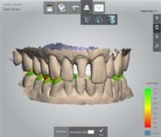 DIOnavi - Fluxo de trabalho Digital Total Dados TCFC Dados Trios Desenho do guia cirúrgico Clínica dentária Digital