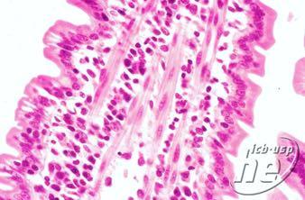 Tecido conjun,vo frouxo Todos os elementos jpicos de tecidos conjun,vos Fibroblastos e macrófagos Pressão e atritos pequenos Preenche espaços