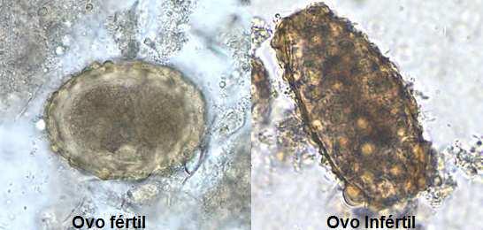 lumbricoides Características Morfológicas OVOS Cor: brancos, mas adquirem coloração castanha devidoao contato com as fezes. Tamanho: cerca de 50 µm de diâmetro.