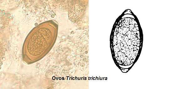 http://fcfrp.usp.br/parasitologia/genero_trichuris.htm VERMES ADULTOS Tamanho: 3 a 5cm de comprimento. Machos menores que as fêmeas.