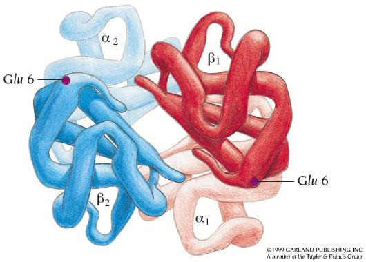 Drepanocitose ou anemia falsiforme Resulta de uma