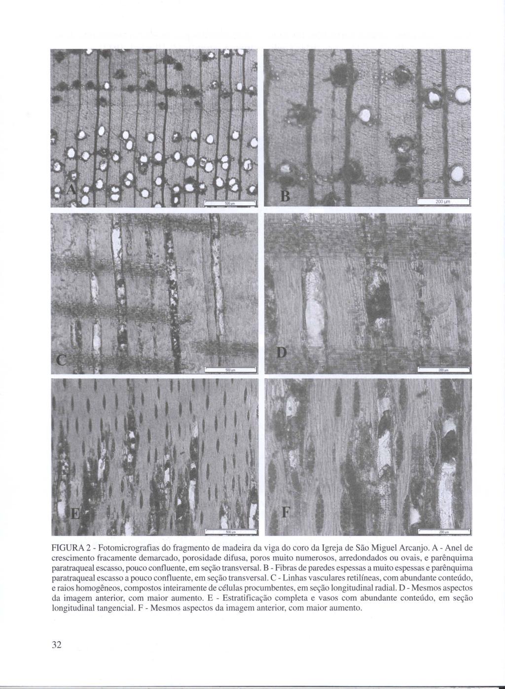 FIGURA 2 - Fotomicrografias do fragmento de madeira da viga do coro da Igreja de São Miguel Arcanjo.